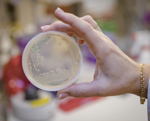 agar plate with bacteria